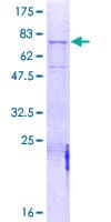 Human MASP1 / MASP Protein (Recombinant GST)
