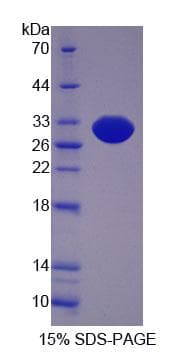 Mouse SCEL Protein (Recombinant His-T7, N-terminus)