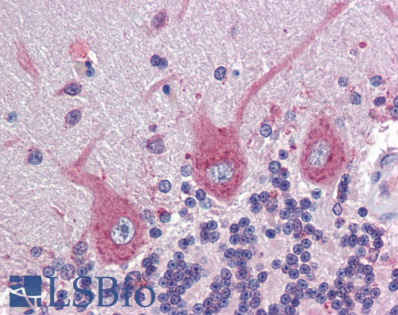 IHC-plus™ Monoclonal Mouse anti-Human EPHB4 / EPH Receptor B4 Antibody (clone 5B5, Extracellular, IHC, IF, WB)