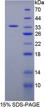 Bovine FGG / Fibrinogen Gamma Protein (Recombinant His-T7)