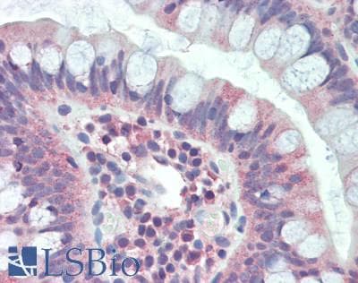 IHC-plus™ PDE4D Antibody (aa759-809)