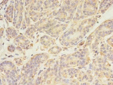 Polyclonal Rabbit anti-Human SYN / FYN Antibody (IHC)