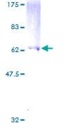 Human GNAI1 / Gi Protein (Recombinant GST)