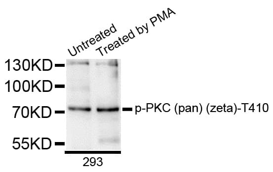 Polyclonal Rabbit anti-Human PRKCZ / PKC-Zeta Antibody (phospho-Thr410, WB)