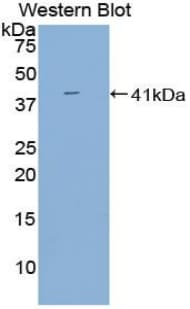 BAFF Receptor / CD268 Antibody (aa96-184, Cy3)