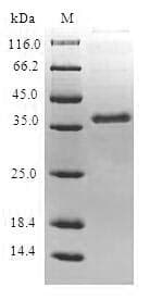 Human CCR4 Protein (Recombinant 10His, N-terminus)