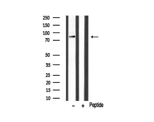 Polyclonal Rabbit anti-Human HRS / HGS Antibody (IHC, IF, WB)
