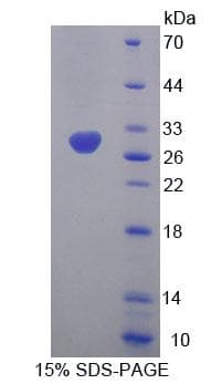 Human MFN1 Protein (Recombinant His, N-Terminal)