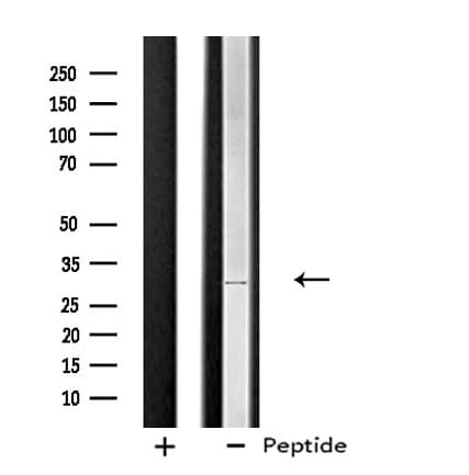STARD10 Antibody