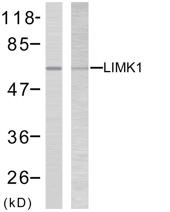 Polyclonal Rabbit anti-Human LIMK2 Antibody (aa471-520, WB)