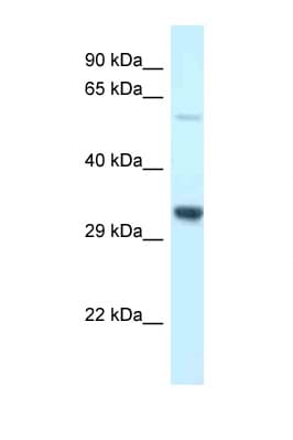 Polyclonal Rabbit anti-Rat TMEM117 Antibody (aa299-348, WB)