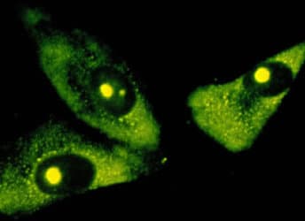 rRNA Antibody (clone 2386)