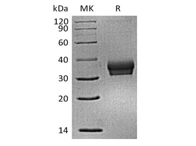 Mouse ANGPTL4 Protein (Recombinant 6His, C-terminus)