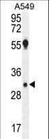 AQP12B / Aquaporin 12B Antibody (aa236-264)