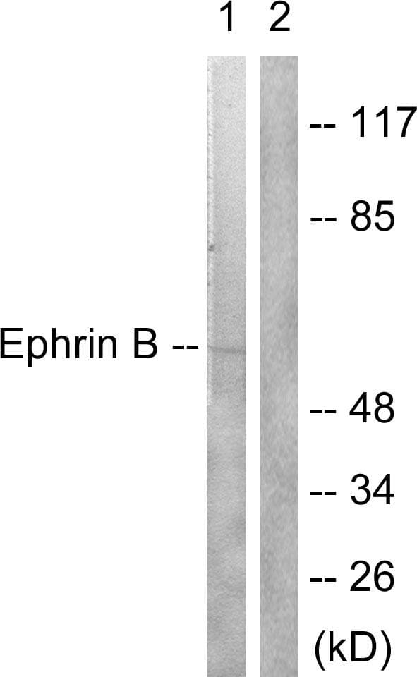 EFNB1 / Ephrin B1 Antibody (p330)