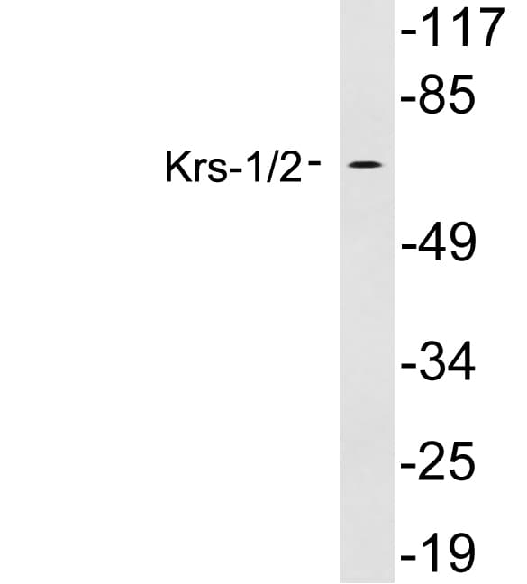 STK3 / STK4 Antibody (aa131-180)