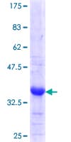 Human PC5 / PCSK5 Protein (Recombinant GST, N-terminus)