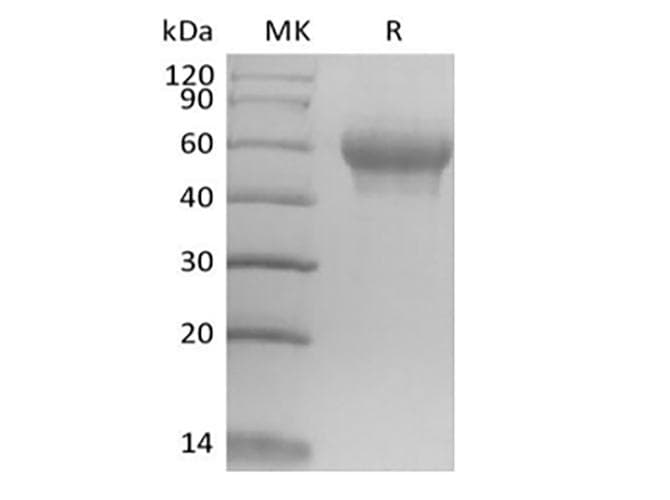 Mouse IL6R / IL6 Receptor Protein (Recombinant 6His, C-terminus)