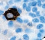 FSH Antibody (Ready-to-Use)