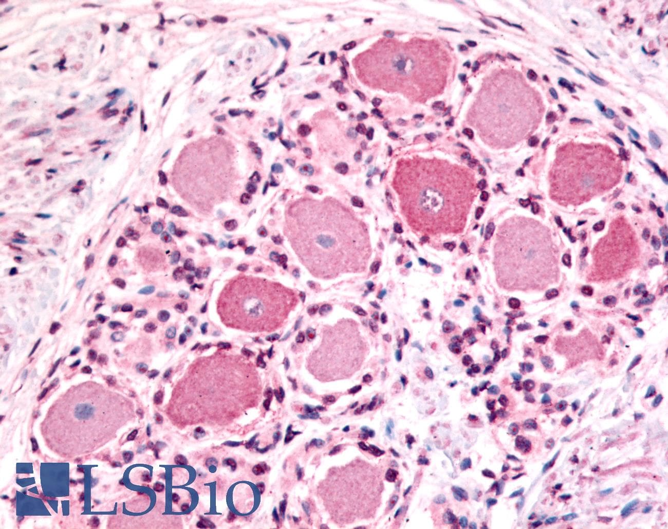 IHC-plus™ HTR1D / 5-HT1D Receptor Antibody (N-Terminus)