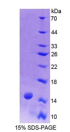 Human BGN / Biglycan Protein (Recombinant His)