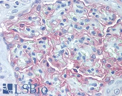 IHC-plus™ Polyclonal Rabbit anti-Human F3 / CD142 / Tissue factor Antibody (aa33-251, IHC)