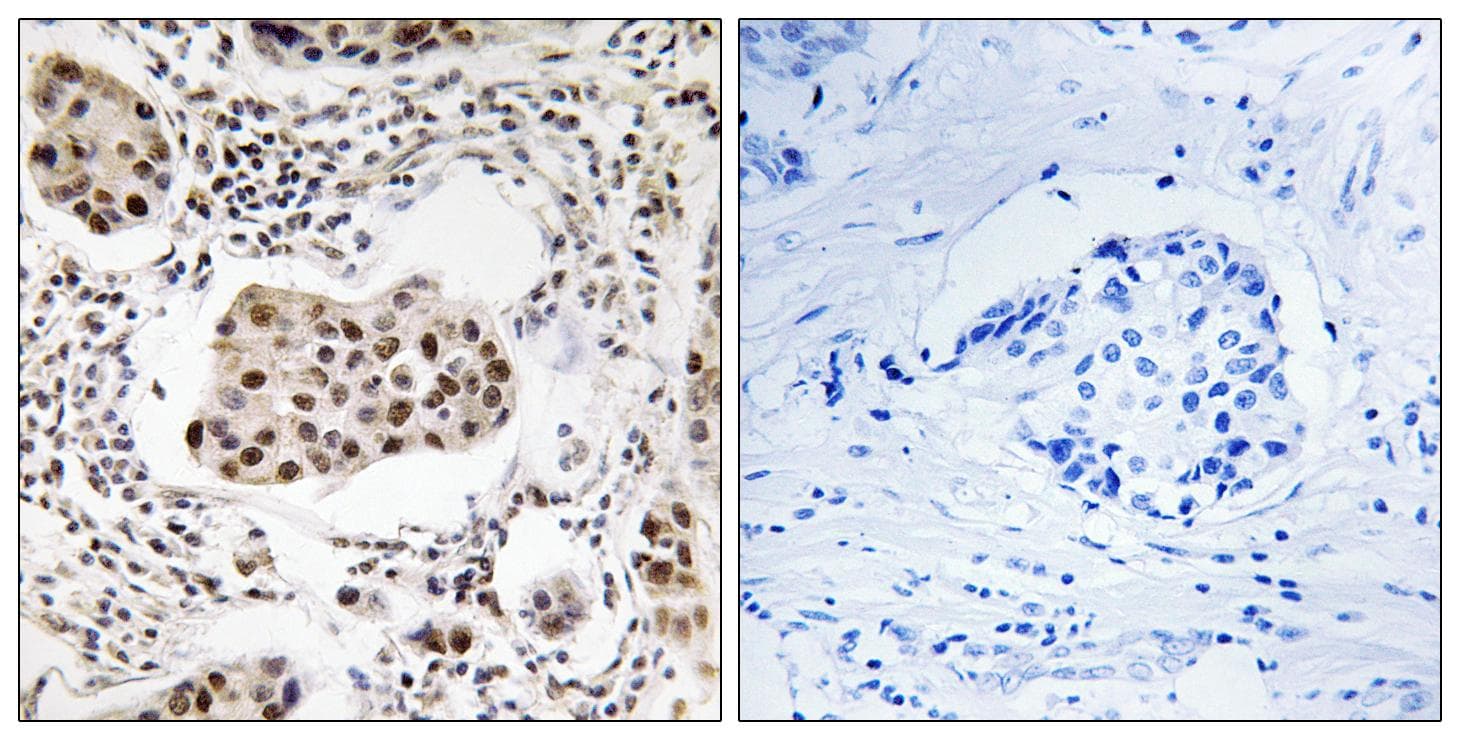 PPP1R11 Antibody