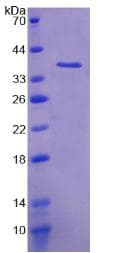 Human HLA-B Protein (Recombinant His-T7)