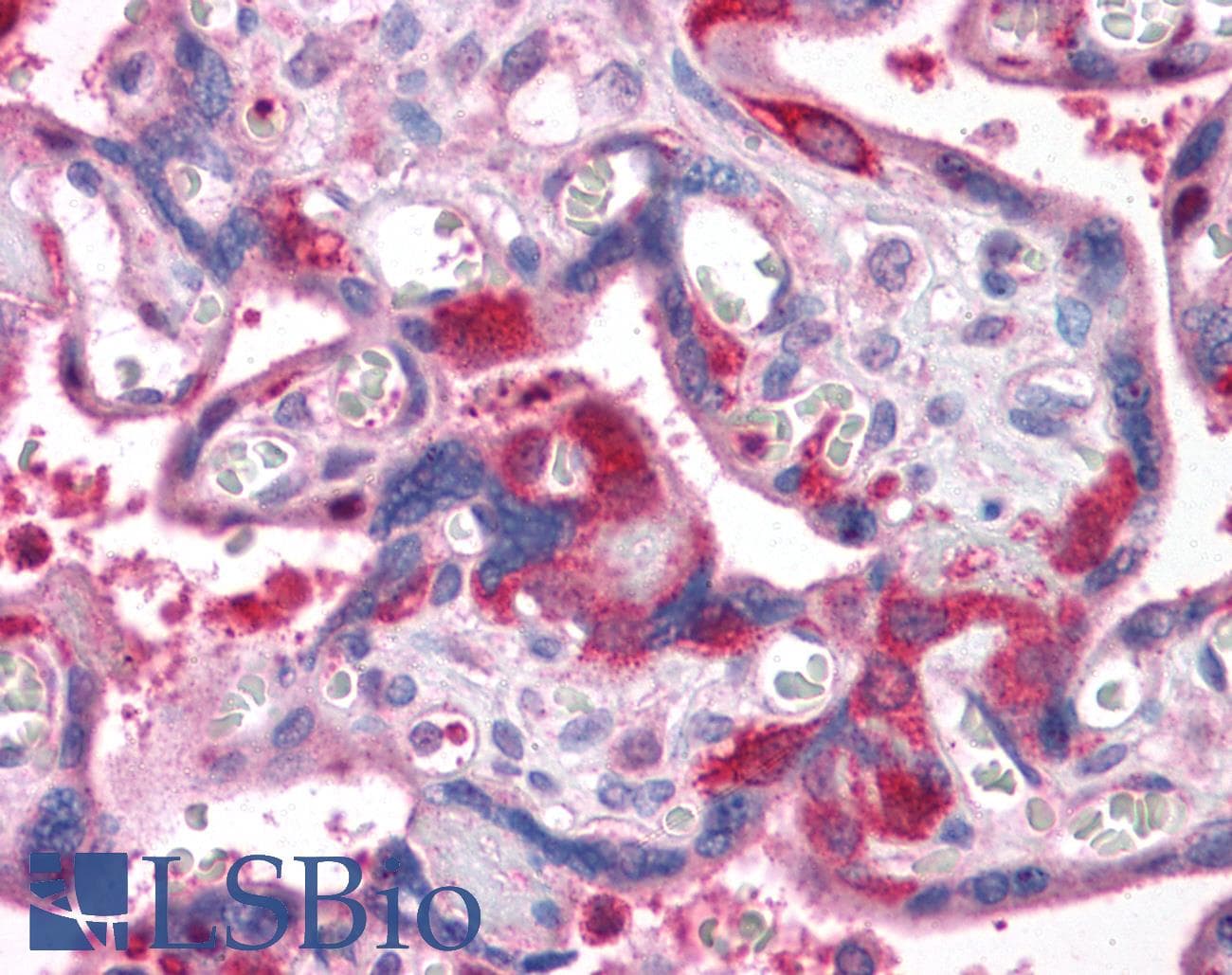 IHC-plus™ Polyclonal Rabbit anti-Human RIPK1 / RIP Antibody (IHC)
