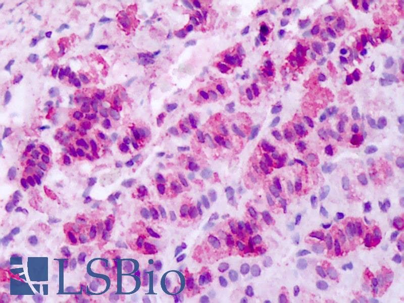 IHC-plus™ MCHR1 Antibody (N-Terminus)