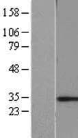 CHMP6 Protein (Over-Expression Lysate Myc-DDK (Flag))