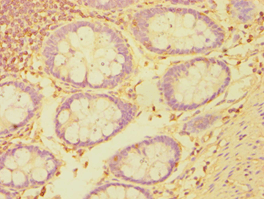 Polyclonal Rabbit anti-Human ETK / BMX Antibody (aa65-280, IHC)