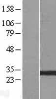 GSTO2 Protein (Over-Expression Lysate Myc-DDK (Flag))