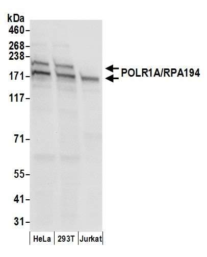 Polyclonal Rabbit anti-Human POLR1A Antibody (aa1425-1475, WB)