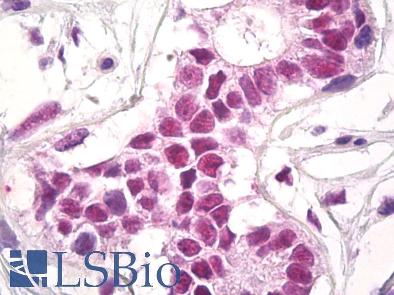 IHC-plus™ RCOR1 / COREST Antibody (aa109-293)