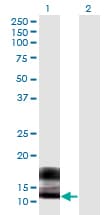 SPRR2F Antibody (clone 5A9)