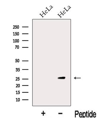 Polyclonal Rabbit anti-Human KCTD5 Antibody (WB)