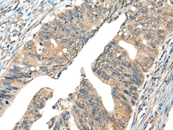 AMID / AIFM2 Antibody