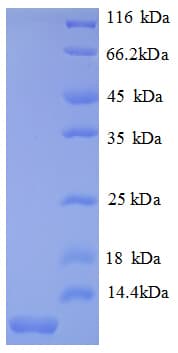 Mouse MIP2 / GRO2 / CXCL2 Protein (Recombinant His)