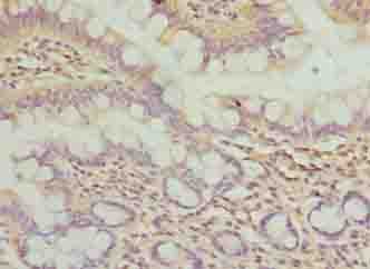 WDR66 Antibody