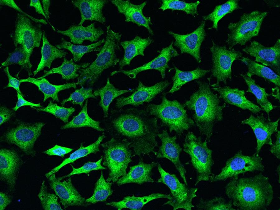 AIMP1 / EMAP II Antibody (Preservative Free)
