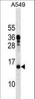 MRPL11 Antibody (aa36-62)