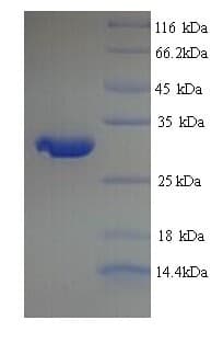 Rat PRNP / PrP / Prion Protein (Recombinant His)