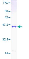 Human IL1RN Protein (Recombinant GST)