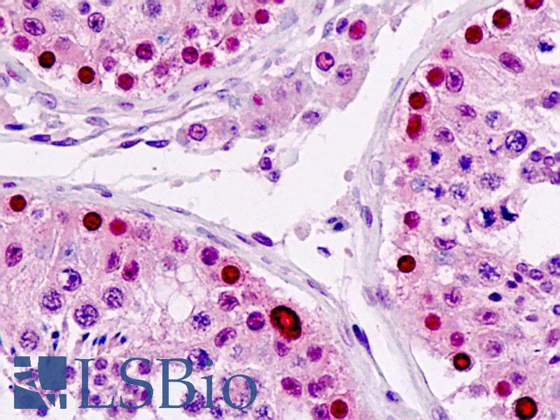 IHC-plus™ LSM2 / SnRNP Antibody (clone AT2B2)