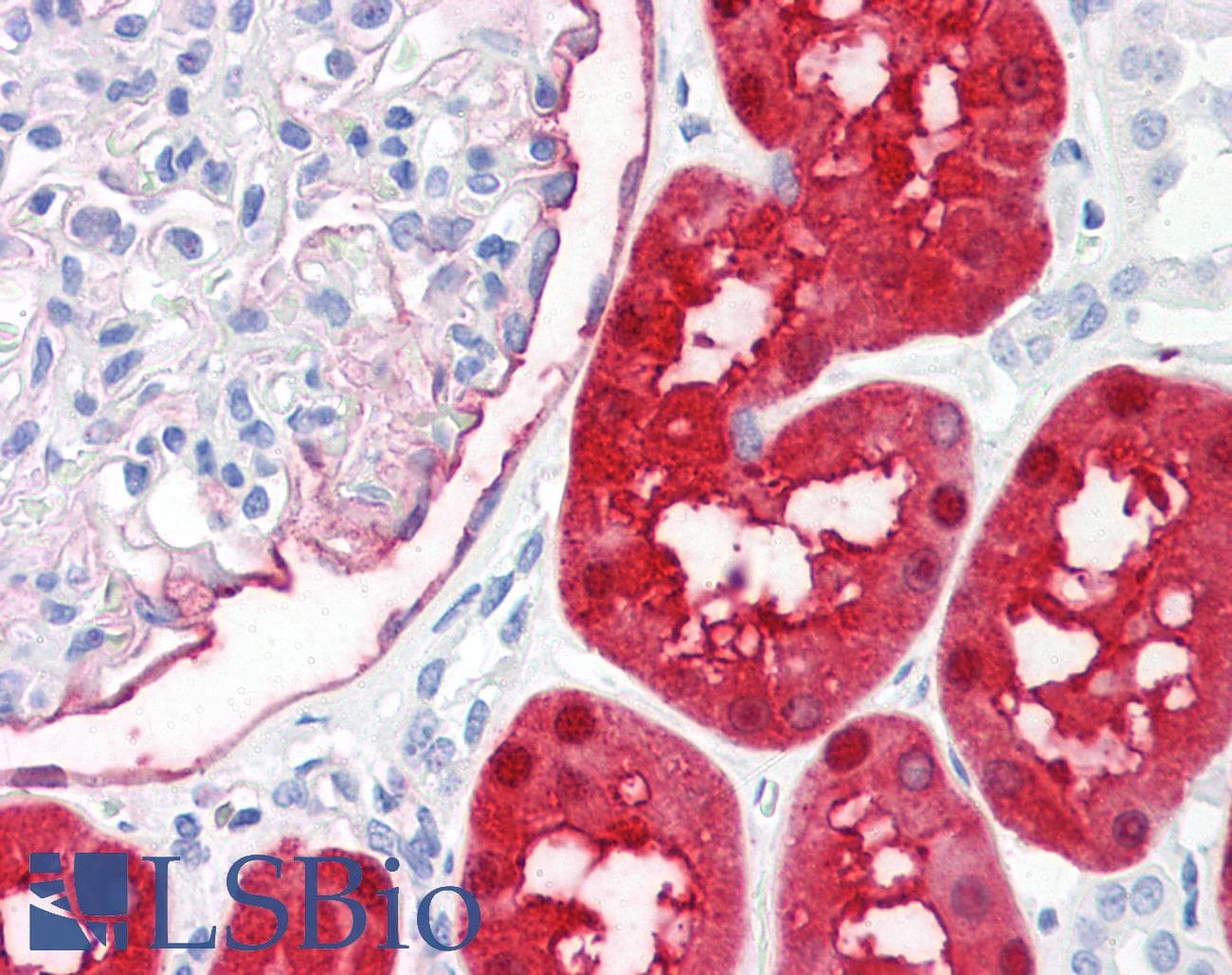 PathPlus™ DDC / DOPA Decarboxylase Antibody (N-Terminus)