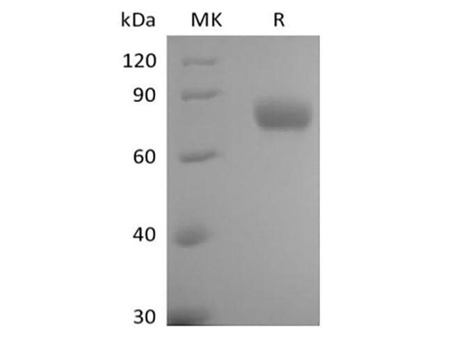 Human ILT2 / CD85 Protein (Recombinant AVI-6His, C-terminus)