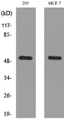 TP / Thymidine Phosphorylase Antibody