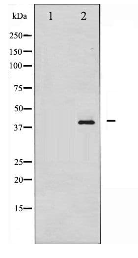 NPM1 / NPM / Nucleophosmin Antibody (phospho-Thr199)
