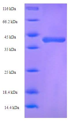 Rat GSTA1 Protein (Recombinant His-SUMO)